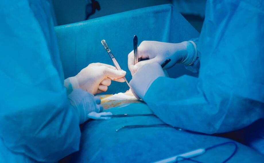 Chirurgia dell'ingrandimento del pene
