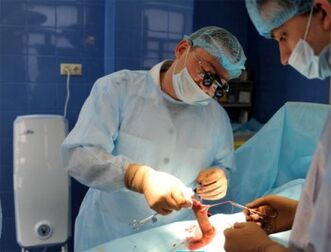 Chirurgia dell'ingrandimento del pene eseguita dal chirurgo
